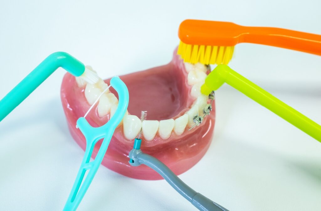 Various teeth-cleaning tools are pictured with a model of the lower mouth, including floss picks, an interdental brush, and a toothbrush.