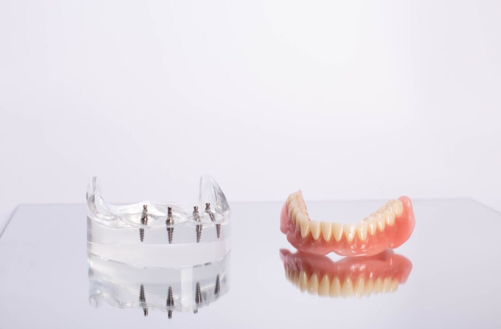 A side-by-side comparison showing the mold of a dental implants on the left and a set of dentures on the right.
